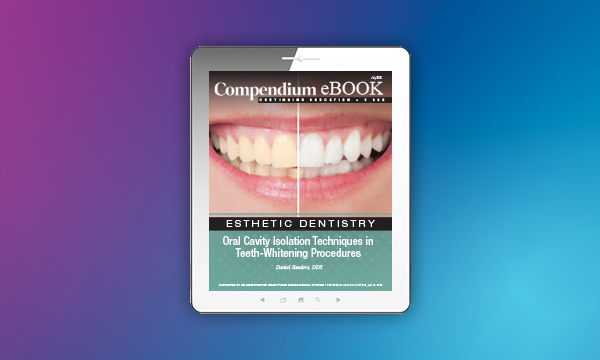 eBook: ‘Oral Cavity Isolation Techniques in Teeth-Whitening Procedures’